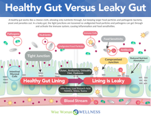 Load image into Gallery viewer, 1. (FIT) FOOD INFLAMMATION & GUT BARRIER TEST (INCLUDES VISIT WITH DR. BURNHAM)